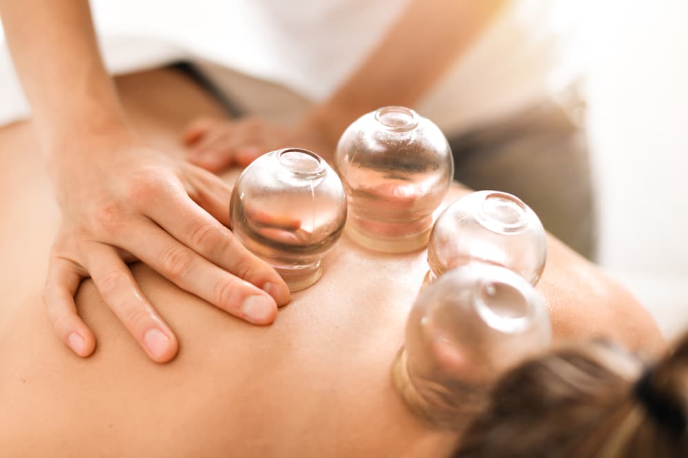 Cupping: Verbeter de bloedstroom